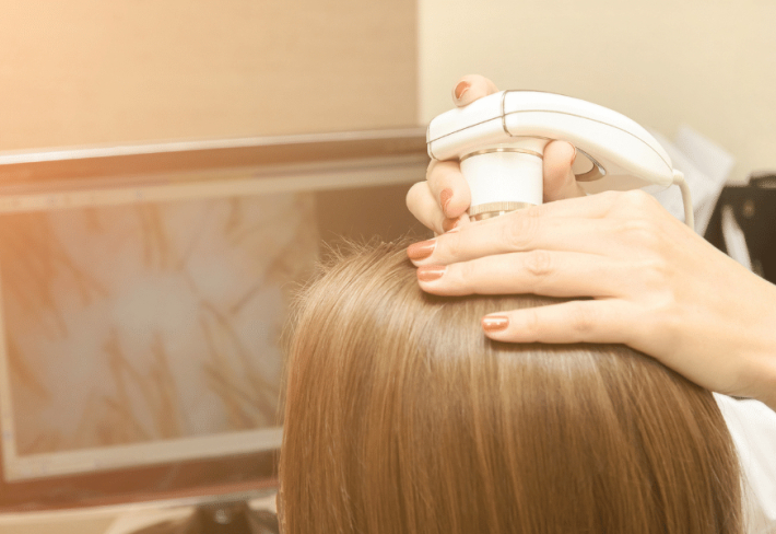 Saç Simülasyonu Scalp Pigmentasyon (SMP) Trikopigmentasyon